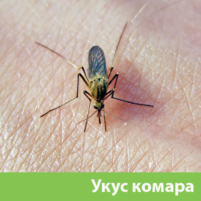 Укусы комаров в Иркутске